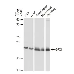 Anti-GPX4 antibody [GT1282] used in Western Blot (WB). GTX03194