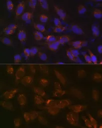 Anti-IGFBP7 antibody [GT1286] used in Immunocytochemistry/ Immunofluorescence (ICC/IF). GTX03198