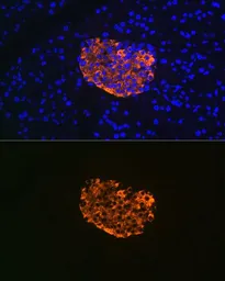 Anti-IGFBP7 antibody [GT1286] used in IHC (Paraffin sections) (IHC-P). GTX03198