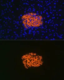 Anti-IGFBP7 antibody [GT1286] used in IHC (Paraffin sections) (IHC-P). GTX03198