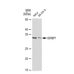 Anti-IGFBP7 antibody [GT1286] used in Western Blot (WB). GTX03198