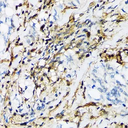 Anti-LMP2 antibody [GT1307] used in IHC (Paraffin sections) (IHC-P). GTX03219