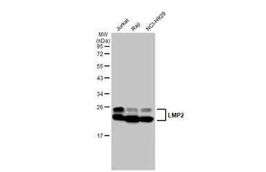 Anti-LMP2 antibody [GT1307] used in Western Blot (WB). GTX03219