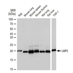 Anti-LMP2 antibody [GT1307] used in Western Blot (WB). GTX03219