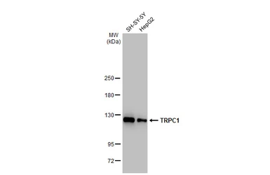 Anti-TRPC1 antibody [GT1318] used in Western Blot (WB). GTX03230