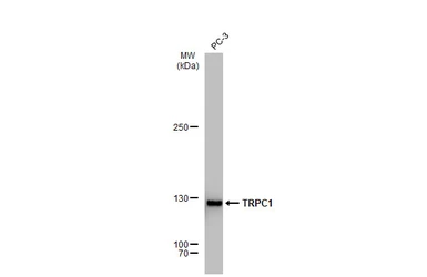 Anti-TRPC1 antibody [GT1318] used in Western Blot (WB). GTX03230