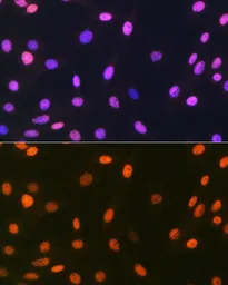 Anti-Macro H2A.1 antibody [GT1329] used in Immunocytochemistry/ Immunofluorescence (ICC/IF). GTX03241