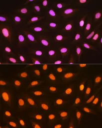 Anti-Macro H2A.1 antibody [GT1329] used in Immunocytochemistry/ Immunofluorescence (ICC/IF). GTX03241