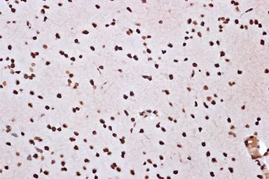 Anti-Macro H2A.1 antibody [GT1329] used in IHC (Paraffin sections) (IHC-P). GTX03241