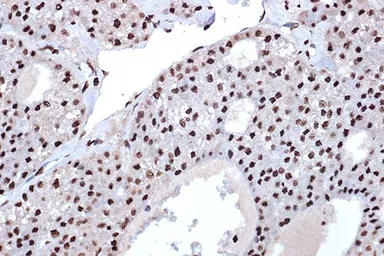 Anti-Macro H2A.1 antibody [GT1329] used in IHC (Paraffin sections) (IHC-P). GTX03241