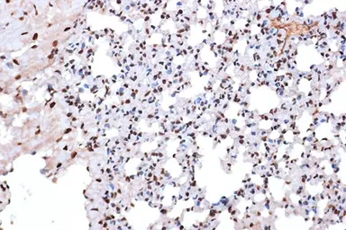 Anti-Macro H2A.1 antibody [GT1329] used in IHC (Paraffin sections) (IHC-P). GTX03241