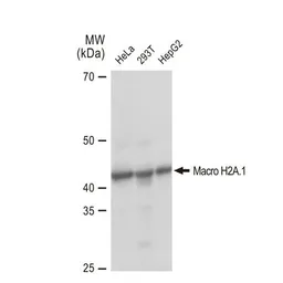 Anti-Macro H2A.1 antibody [GT1329] used in Western Blot (WB). GTX03241