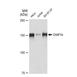 Anti-CHAF1A antibody [GT1332] used in Western Blot (WB). GTX03244