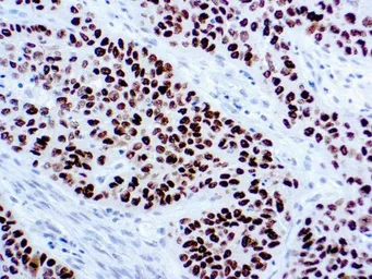 Anti-IL12B / IL12 p40 antibody used in IHC (Paraffin sections) (IHC-P). GTX03337