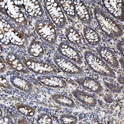 Anti-TJP2 antibody used in IHC (Paraffin sections) (IHC-P). GTX03355