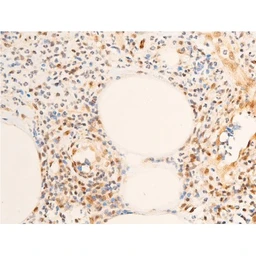 Anti-Her2 / ErbB2 (phospho Tyr1248) antibody used in IHC (Paraffin sections) (IHC-P). GTX03358