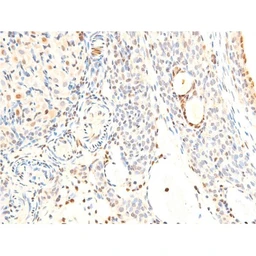 Anti-Her2 / ErbB2 (phospho Tyr1248) antibody used in IHC (Paraffin sections) (IHC-P). GTX03358