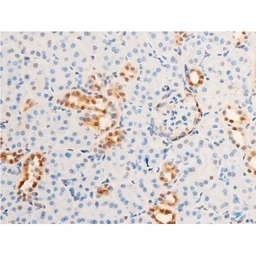 Anti-Her2 / ErbB2 (phospho Tyr1248) antibody used in IHC (Paraffin sections) (IHC-P). GTX03358