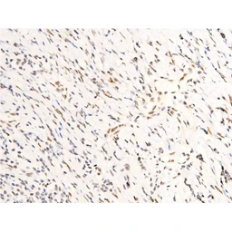 Anti-Her2 / ErbB2 (phospho Tyr1248) antibody used in IHC (Paraffin sections) (IHC-P). GTX03358