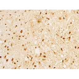 Anti-Her2 / ErbB2 (phospho Tyr1248) antibody used in IHC (Paraffin sections) (IHC-P). GTX03358