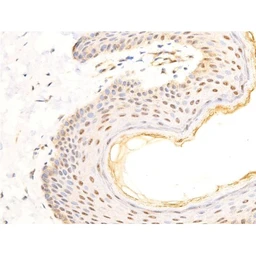 Anti-Her2 / ErbB2 (phospho Tyr1248) antibody used in IHC (Paraffin sections) (IHC-P). GTX03358