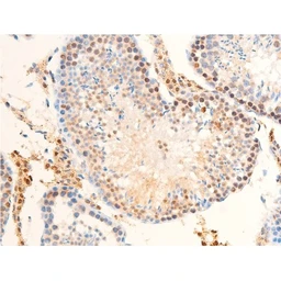 Anti-Her2 / ErbB2 (phospho Tyr1248) antibody used in IHC (Paraffin sections) (IHC-P). GTX03358