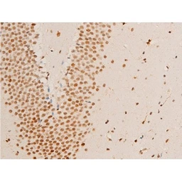 Anti-Her2 / ErbB2 (phospho Tyr1248) antibody used in IHC (Paraffin sections) (IHC-P). GTX03358