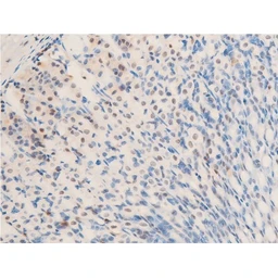 Anti-Her2 / ErbB2 (phospho Tyr1248) antibody used in IHC (Paraffin sections) (IHC-P). GTX03358