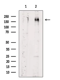 Anti-Her2 / ErbB2 (phospho Tyr1248) antibody used in Western Blot (WB). GTX03358