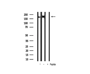 Anti-Her2 / ErbB2 (phospho Tyr1248) antibody used in Western Blot (WB). GTX03358