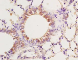 Anti-PPAR gamma antibody used in IHC (Paraffin sections) (IHC-P). GTX03364