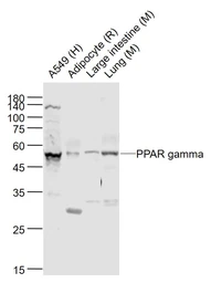 Anti-PPAR gamma antibody used in Western Blot (WB). GTX03364