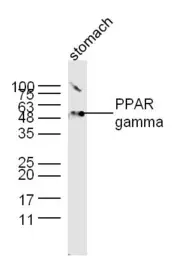 Anti-PPAR gamma antibody used in Western Blot (WB). GTX03364