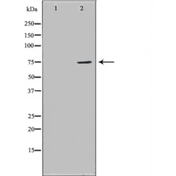 Anti-HDC antibody used in Western Blot (WB). GTX03370