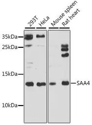 Anti-SAA4 antibody used in Western Blot (WB). GTX03425