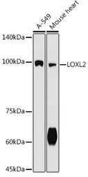 Anti-LOXL2 antibody used in Western Blot (WB). GTX03428