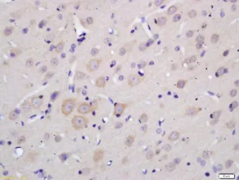 Anti-MOBP antibody used in IHC (Paraffin sections) (IHC-P). GTX03460