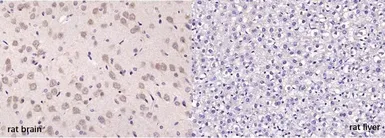 Anti-MOBP antibody used in IHC (Paraffin sections) (IHC-P). GTX03460