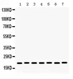 Anti-Lysozyme antibody used in Western Blot (WB). GTX03467