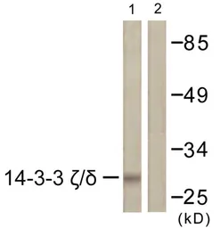 Anti-14-3-3 zeta antibody used in Western Blot (WB). GTX03589