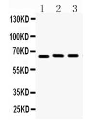 Anti-Lamin B1 antibody used in Western Blot (WB). GTX03695