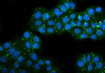 Anti-Claudin 3 antibody used in Immunocytochemistry/ Immunofluorescence (ICC/IF). GTX03712