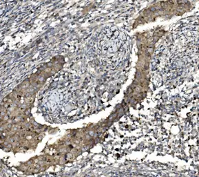 Anti-Claudin 3 antibody used in IHC (Paraffin sections) (IHC-P). GTX03712