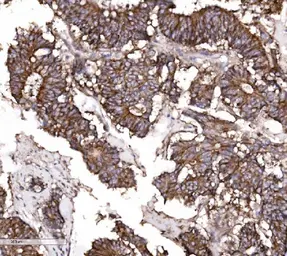 Anti-Claudin 3 antibody used in IHC (Paraffin sections) (IHC-P). GTX03712