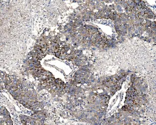 Anti-Claudin 3 antibody used in IHC (Paraffin sections) (IHC-P). GTX03712