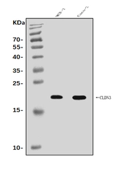 Anti-Claudin 3 antibody used in Western Blot (WB). GTX03712