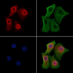 Anti-BRCA2 (phospho Ser2095) antibody used in Immunocytochemistry/ Immunofluorescence (ICC/IF). GTX03783