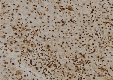 Anti-BRCA2 (phospho Ser2095) antibody used in IHC (Paraffin sections) (IHC-P). GTX03783