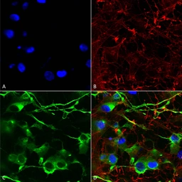 Anti-KCC2 antibody [S1-12] used in Immunocytochemistry/ Immunofluorescence (ICC/IF). GTX03805