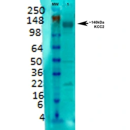 Anti-KCC2 antibody [S1-12] used in Western Blot (WB). GTX03805